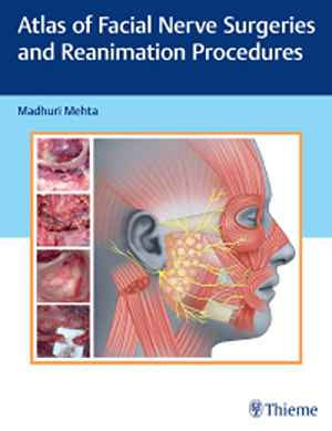 Atlas of Facial Nerve Surgeries and Reanimation Procedures 1st