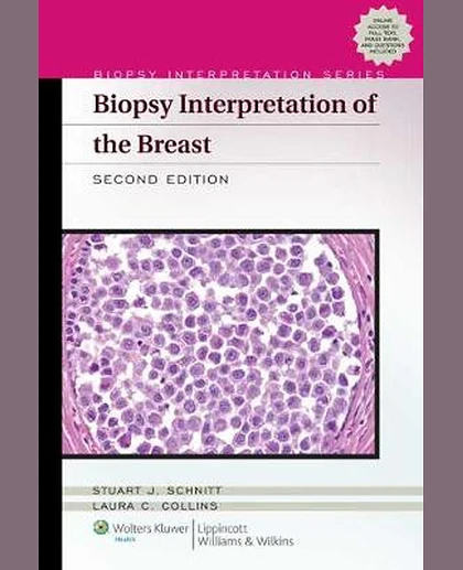 Biopsy Interpretation of the Breast