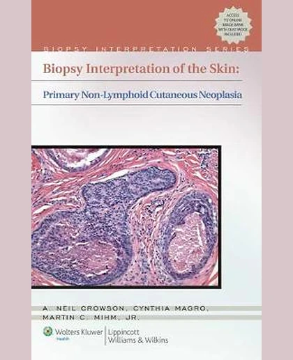 Biopsy Interpretation of the Skin: Primary Non-Lymphoid Neoplasms of the Skin