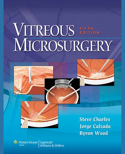Vitreous Microsurgery