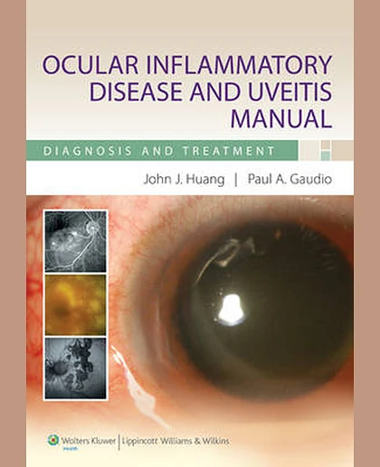 Ocular Inflammatory Disease and Uveitis Manual: Diagnosis and Treatment