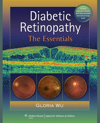 Diabetic Retinopathy: The Essentials