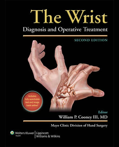 The Wrist: Diagnosis and Operative Treatment