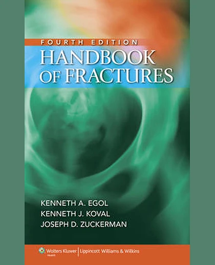 Handbook of Fractures