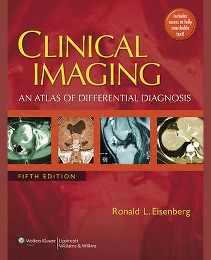 Clinical Imaging: An Atlas of Differential Diagnosis