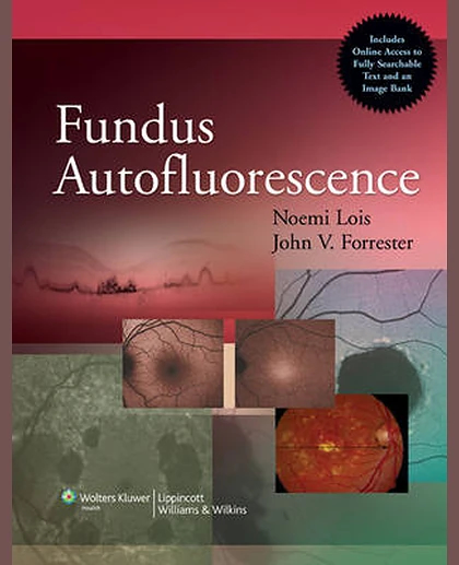 Fundus Autofluorescence