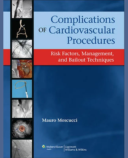 Complications of Cardiovascular Procedures: Risk Factors, Management, and Bailout Techniques