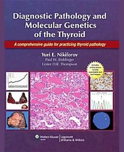 Diagnostic Pathology and Molecular Genetics of the Thyroid: A Comprehensive Guide for Practicing Thyroid Pathology