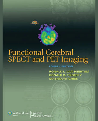 Functional Cerebral SPECT and PET Imaging