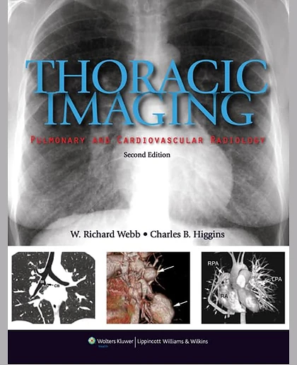 Thoracic Imaging: Pulmonary and Cardiovascular Radiology