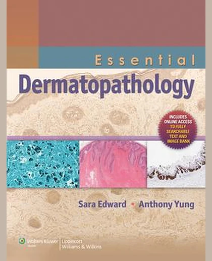 Essential Dermatopathology