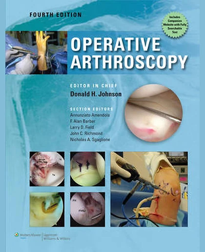 Operative Arthroscopy