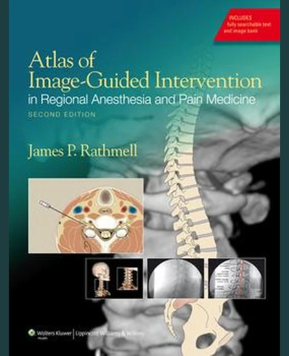 Atlas of Image-Guided Intervention in Regional Anesthesia and Pain Medicine