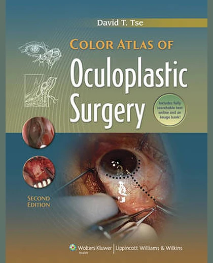 Color Atlas of Oculoplastic Surgery