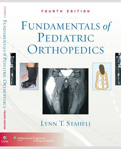 Fundamentals of Pediatric Orthopedics