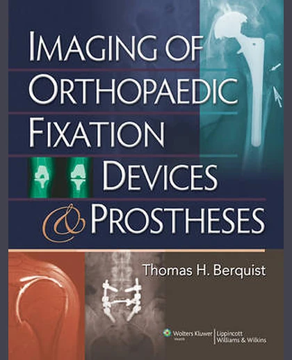 Imaging of Orthopaedic Fixation Devices and Prostheses