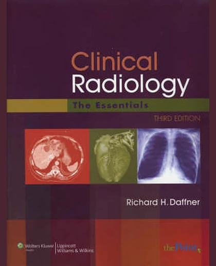 Clinical Radiology: The Essentials
