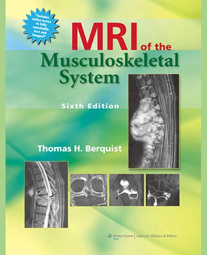 MRI of the Musculoskeletal System