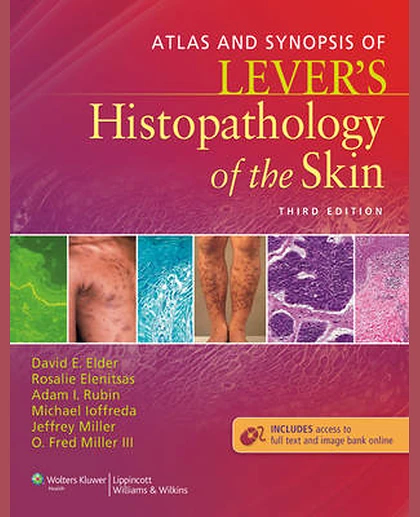 Atlas and Synopsis of Lever's Histopathology of the Skin