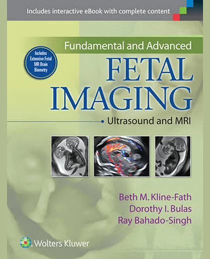 Fundamental and Advanced Fetal Imaging: Ultrasound and MRI