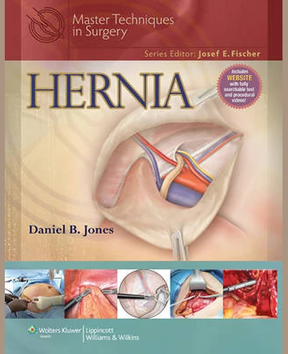 Master Techniques in Surgery: Hernia