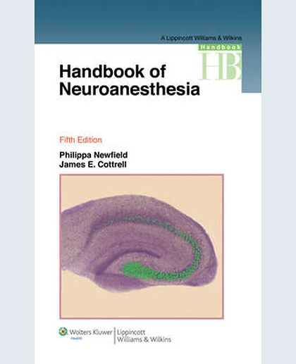 Handbook of Neuroanesthesia