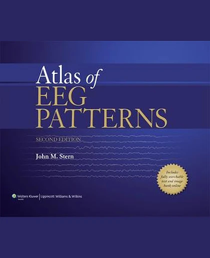 Atlas of EEG Patterns