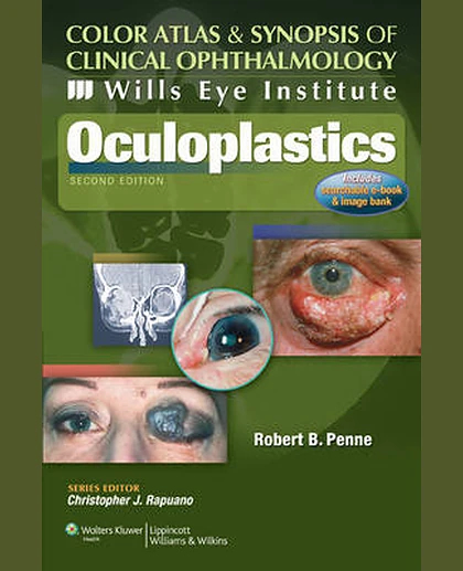 Wills Eye Institute - Oculoplastics