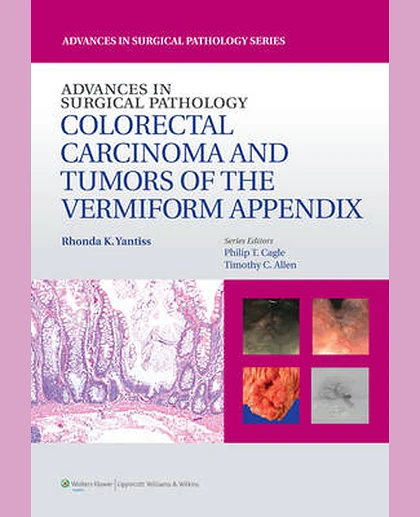 Advances in Surgical Pathology: Colorectal Carcinoma and Tumors of the Vermiform Appendix