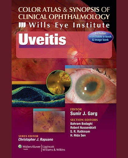 Wills Eye Institute - Uveitis