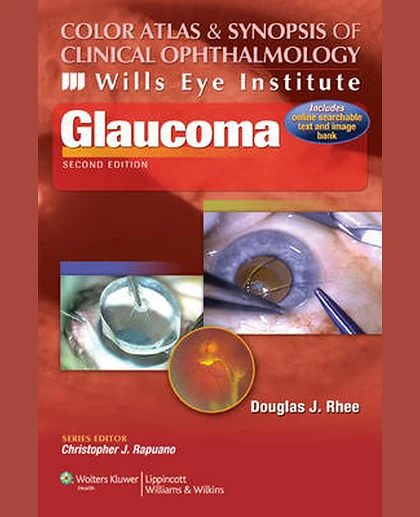 Color Atlas and Synopsis of Clinical Ophthalmology -- Wills Eye Institute -- Glaucoma