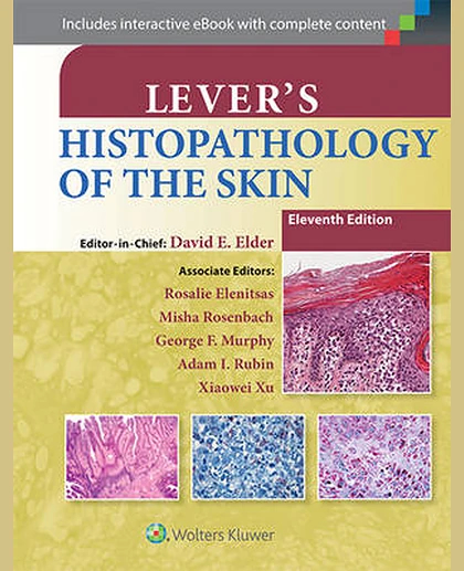Lever's Histopathology of the Skin