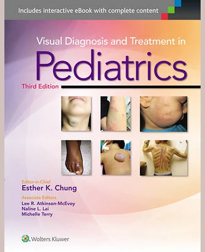 Visual Diagnosis and Treatment in Pediatrics