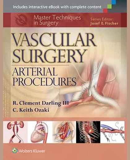 Master Techniques in Surgery: Vascular Surgery: Arterial Procedures