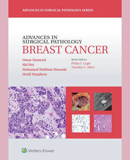 Advances in Surgical Pathology: Breast cancer