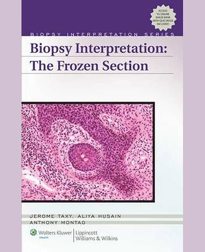Biopsy Interpretation: The Frozen Section