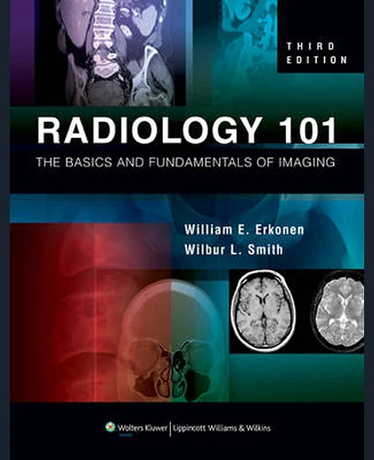 Radiology 101: The Basics and Fundamentals of Imaging