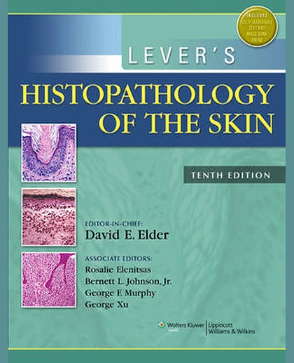 Lever's Histopathology of the Skin