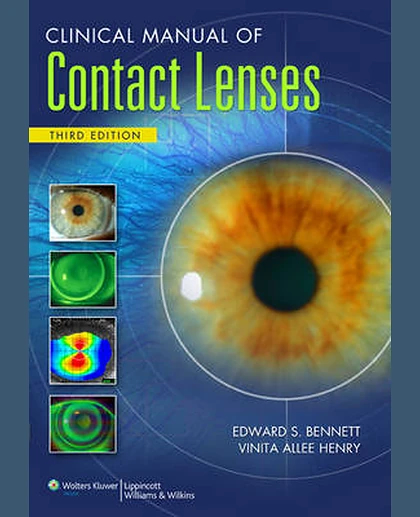 Clinical Manual of Contact Lenses