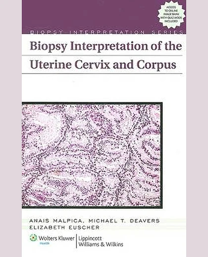 Biopsy Interpretation of the Uterine Cervix and Corpus
