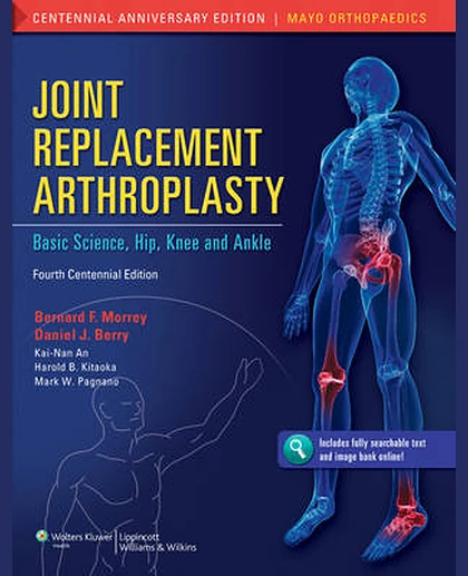 Joint Replacement Arthroplasty: Hip, knee, and ankle