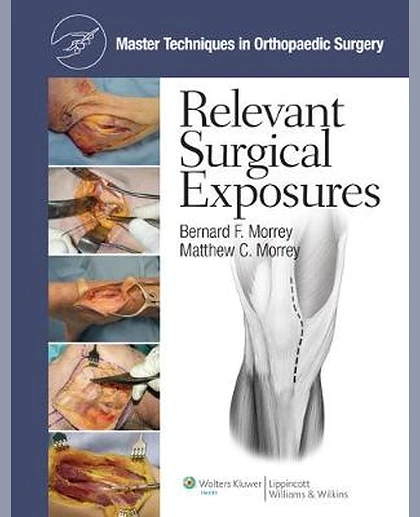 Relevant Surgical Exposures