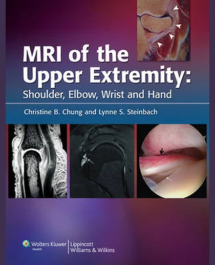 MRI of the Upper Extremity: Shoulder, Elbow, Wrist and Hand