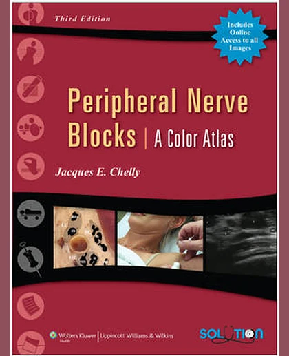 Peripheral Nerve Blocks: A Color Atlas