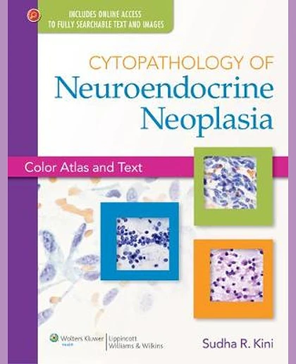 Cytopathology of Neuroendocrine Neoplasia: Color Atlas and Text