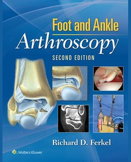 Foot & Ankle Arthroscopy