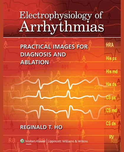 Electrophysiology of Arrhythmias: Practical Images for Diagnosis and Ablation