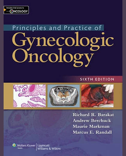 Principles and Practice of Gynecologic Oncology