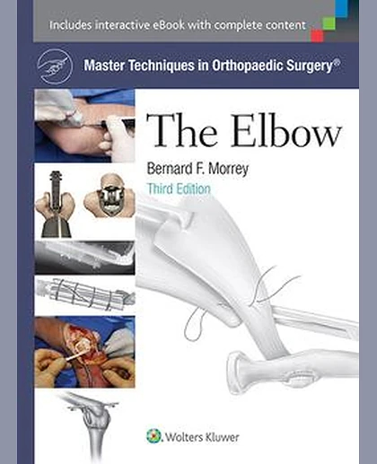 Master Techniques in Orthopaedic Surgery: The Elbow