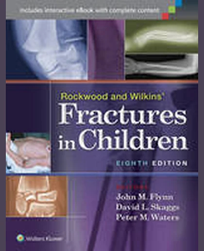 Rockwood and Wilkins' Fractures in Children